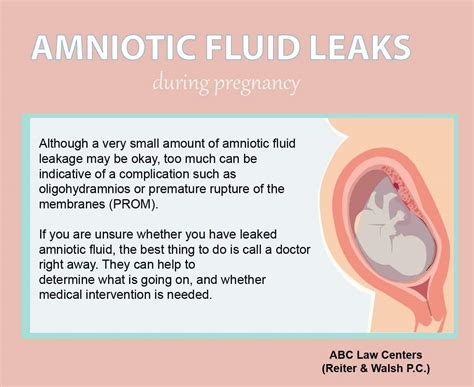 how to know if amniotic fluid is leaking|Signs Of Leaking Amniotic Fluid Vs. Discharge: The。